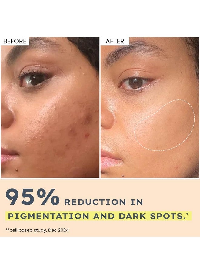 Hyphen 44% Rice Water Brightening Face Serum Pads | 5% Niacinamide & Alpha Arbutin to Reduces Dark Spots & Pigmentation | Toner Pads with Serum for Glowing Glass Skin | All Skin Types - 50N - Image 4