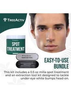 TreeActiv TreeActiv Spot Treatment 0.5oz + Remover Kit Bundle, Includes Spot Treatment and Remover Tool, Bentonite Clay, Tea Tree Oil, Aloe Vera, Clearer Skin in 2 Weeks  - Image 3