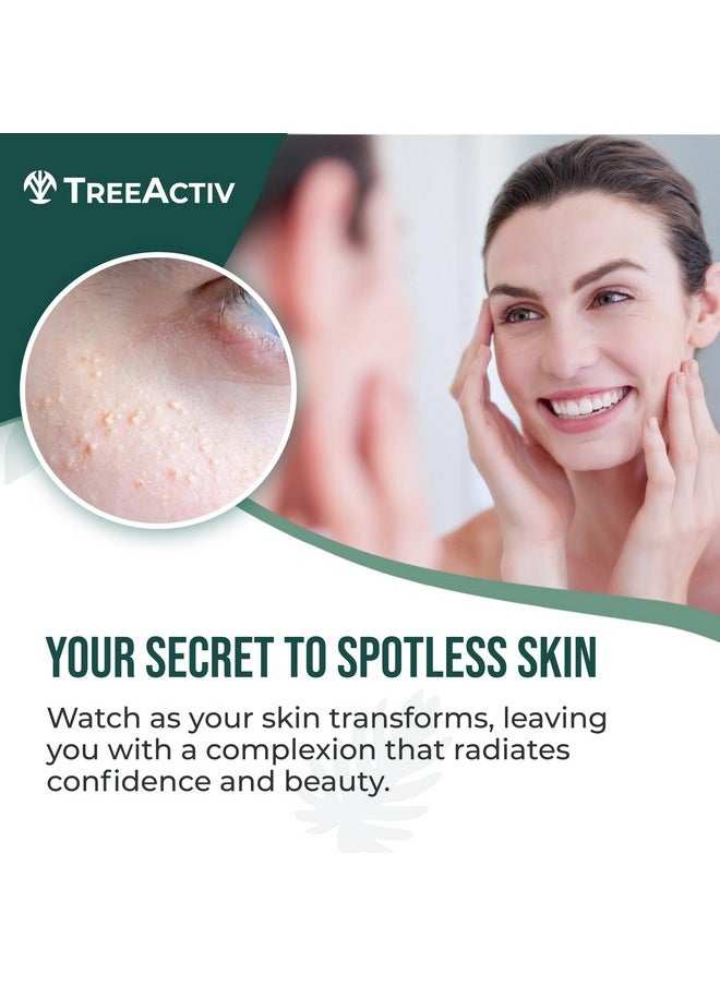 TreeActiv TreeActiv Spot Treatment 0.5oz + Remover Kit Bundle, Includes Spot Treatment and Remover Tool, Bentonite Clay, Tea Tree Oil, Aloe Vera, Clearer Skin in 2 Weeks  - Image 2
