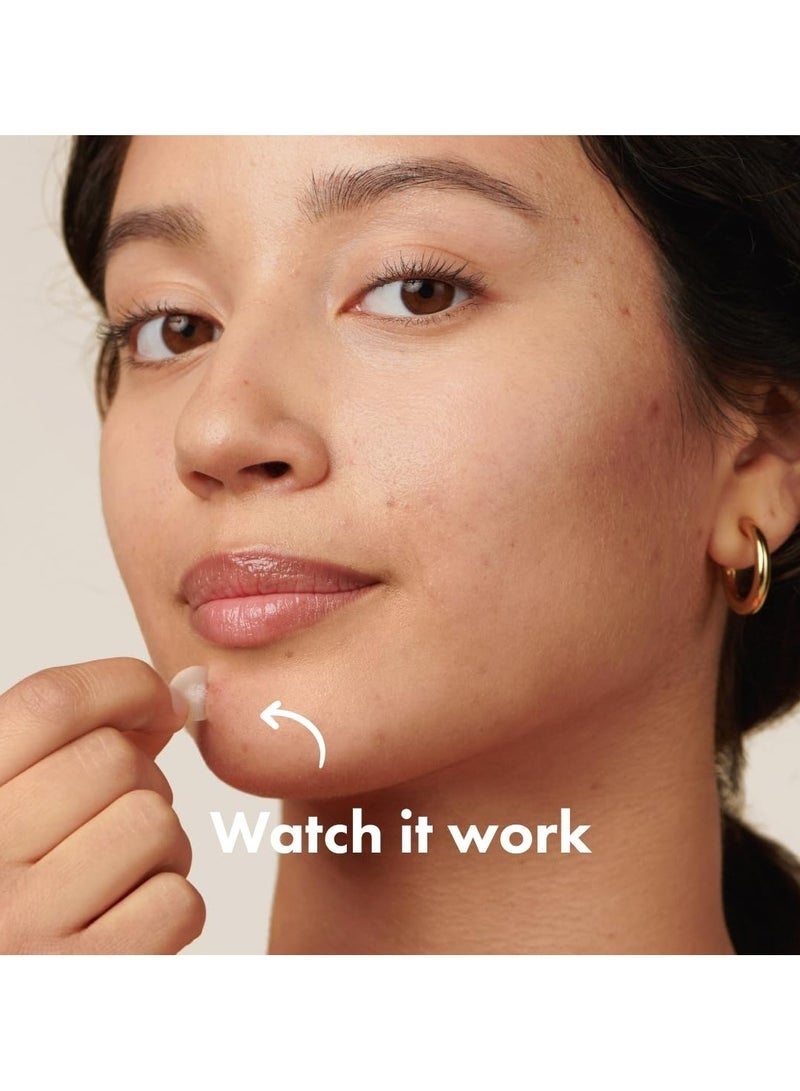 Hero (72 Count)Powerful Acne Pimple Patch – Hydrocolloid Spot Treatment for Face and Skin, Invisible Waterproof Acne Patch for Overnight Healing - Image 2