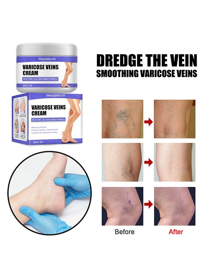 West&Month Varicose Vein Cream 30g, Restore Leg Skin Smoothness, Reduces Puffiness, Improves the Appearance of Leg, Soothes Tired Legs - Image 2