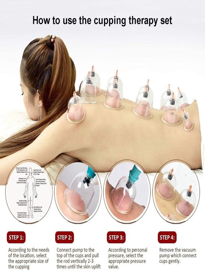 Vinban 12 Cups Hijama Cupping Set with Pump for Back Neck Joint Pain Relief - Image 3