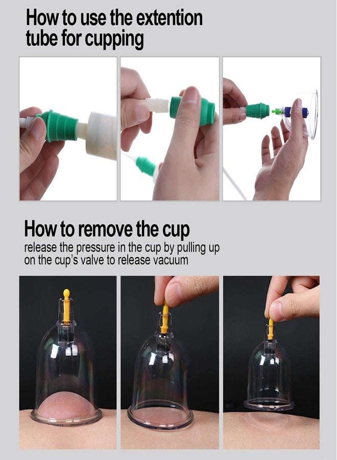 Vinban 12 Cups Hijama Cupping Set with Pump for Back Neck Joint Pain Relief - Image 5