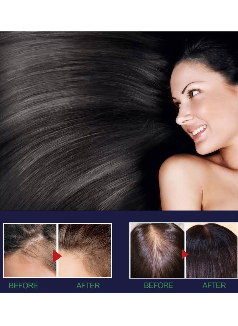 OUHOE - Hair Growth Spray for Nourishing Hair Growth Supple Black Set of 2Pcs - Image 1