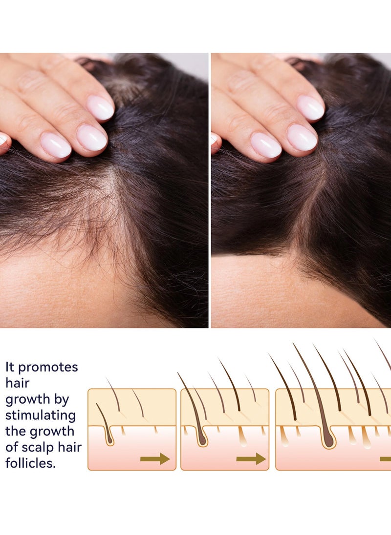 OUHOE - Hair Growth Spray for Nourishing Hair Growth Supple Black Set of 2Pcs - Image 1