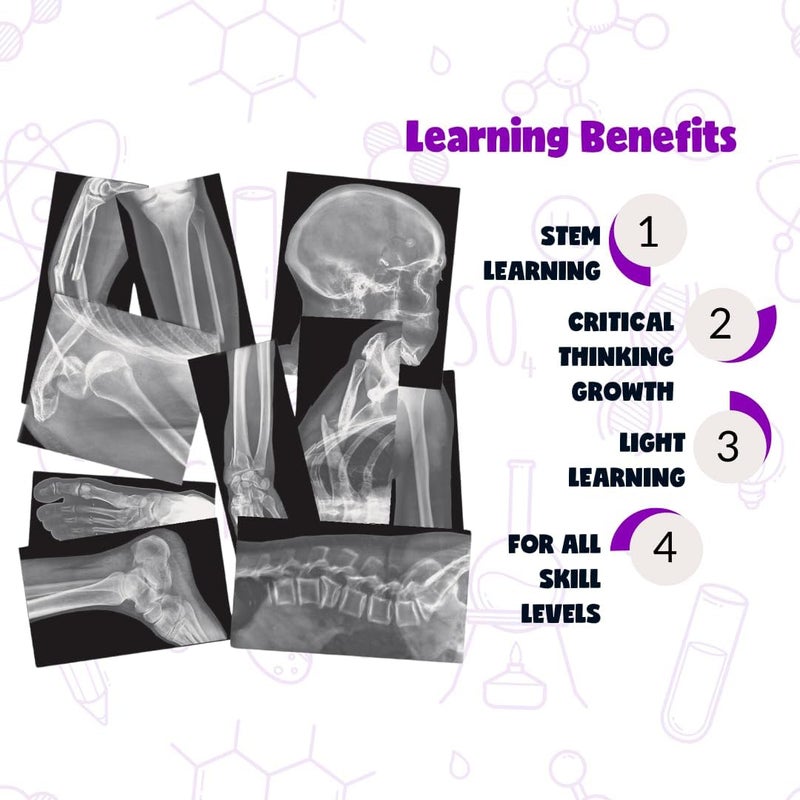 Roylco Broken Bones X-Ray Set for Educational Play - Image 2