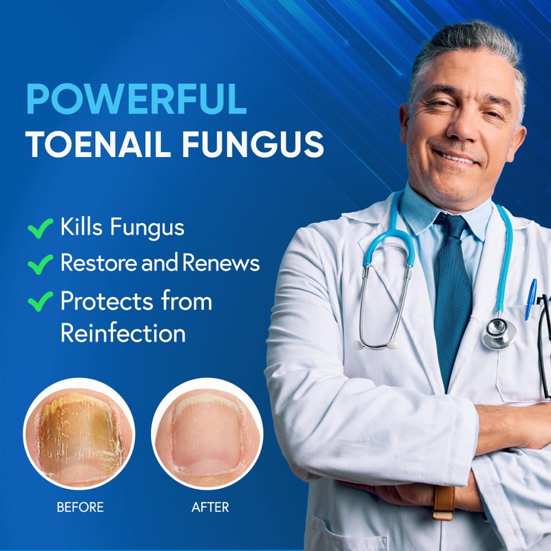 Tobcharm Toenail Fungus Treatment Extra Strength with 25% Undecylenic Acid & Tea Tree Oil, Nail Fungus Treatment for Toenail & Fingernails, Antifungal Nail Treatment for Damaged Nails and Thick Toenails- 2Pcs - Image 2