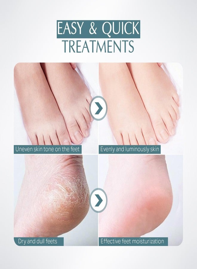 FREEORR 5 Pairs Foot Mask with Niacinamide, Deeply Moisturizing Hydrating Foot Masks for Dry Cracked Skin with Shea Butter, Dead Skin Remove, Easy to Use Exfoliating Socks Design for Women Men - Image 5