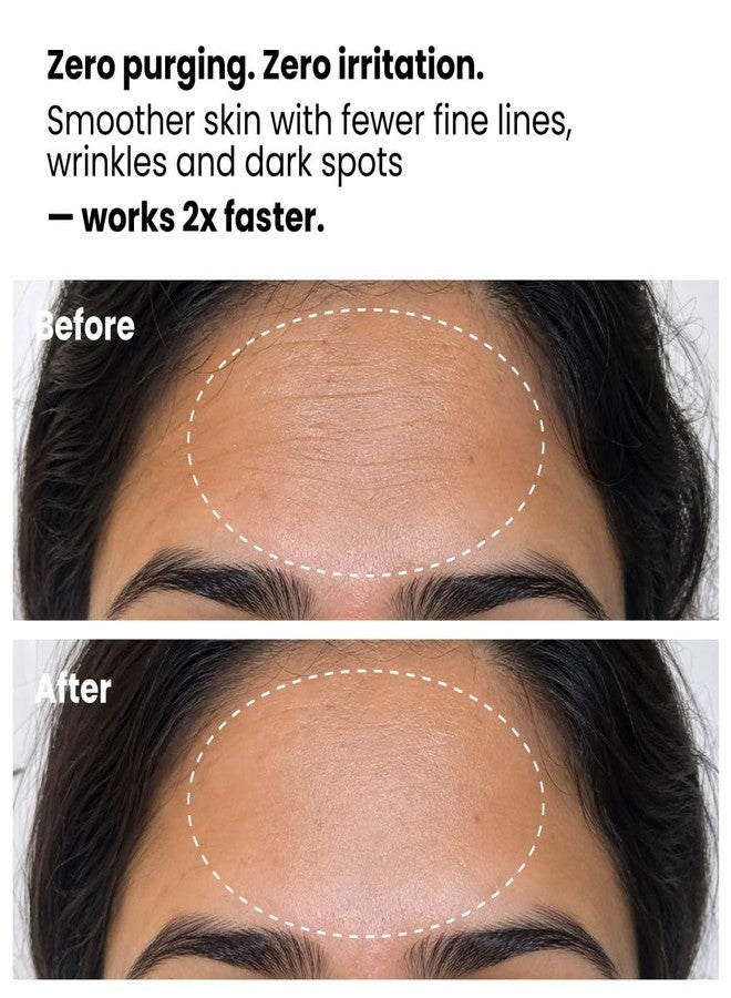 Foxtale 0.15% Beginner Friendly Retinol Night Serum | Anti-Aging Night Cream | Reduces Fine Lines and Wrinkles | No Purging | For Younger-looking Skin | Men & Women | All Skin Types - 30 ml - Image 5