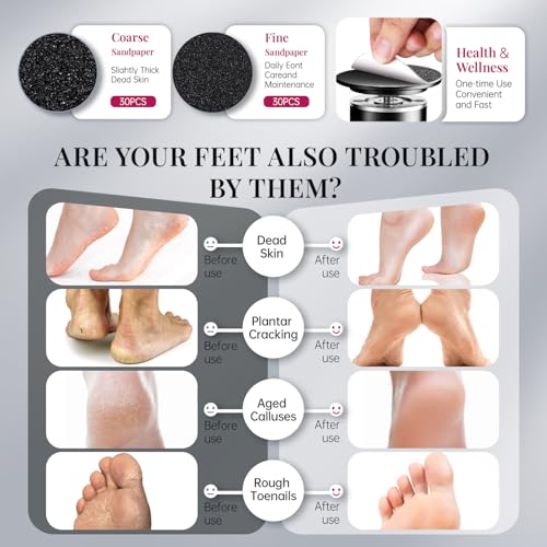 krofaue 1000RPM Electric Callus Remover - Professional Aluminum Foot File Adjustable Pedicure Tool with 60pcs Sandpaper Discs for Dead Skin at Home - Image 4