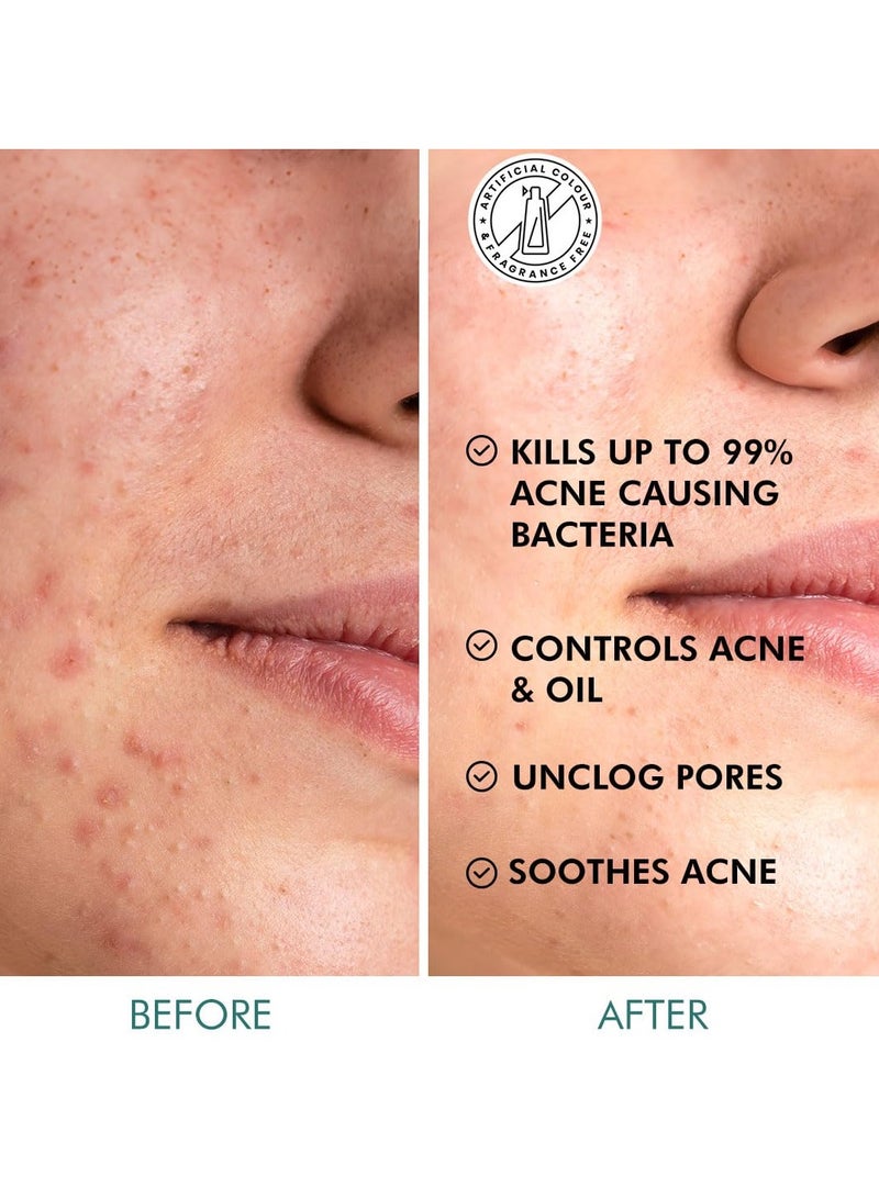 إم كافيين 2٪ ضمادات حمض الساليسيليك حمض الساليسيليك الزنك بي سي ايه وشاي ماتشا لتصفية البشرة | ضمادات سيروم مقشر مضاد لحب الشباب للبشرة المعرضة لحب الشباب | للنساء والرجال - 40 ن (x1) - Image 3