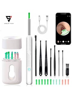 Senlon Tiger Ear Wax Removal, Wi-Fi Visible Ear Cleaner Kit with 12 Ear Pickers and Storage Case, Ear Wax Removal Tool with 1080 HD Camera and 6 Ear Scoops (White)  - Image 1