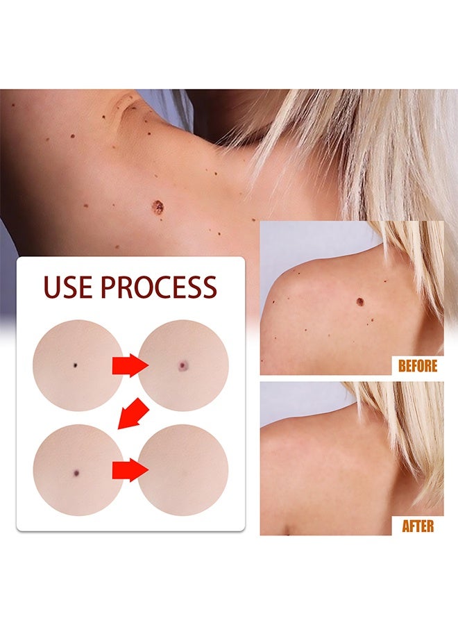 West&Month Tags & Moles Remover - Gram Wart Liquid Pen Quick & Safe Removal 3ML - Image 5