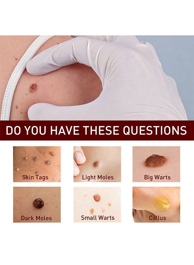 West&Month Tags & Moles Remover - Gram Wart Liquid Pen Quick & Safe Removal 3ML - Image 3