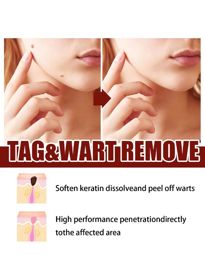 West&Month Tags & Moles Remover - Gram Wart Liquid Pen Quick & Safe Removal 3ML - Image 4