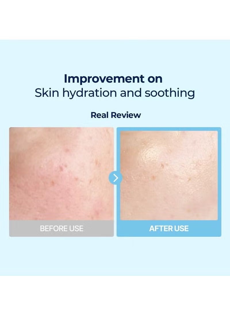 Torriden DIVE IN Multi Pad (80 pads) | Serum infused Facial Pads for Cooling, Soothing, Hydrating Spot Masking | Hyaluronic Acid, Panthenol, Allantoin - Image 3