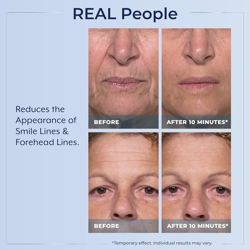 Plexaderm Rapid Reduction Eye Serum - Visibly Reduces Under-Eye Bags, Wrinkles, Dark Circles, Fine Lines & Crow's Feet Instantly, Anti Aging Wrinkle Remover for Face, Full Size Tube - Image 4