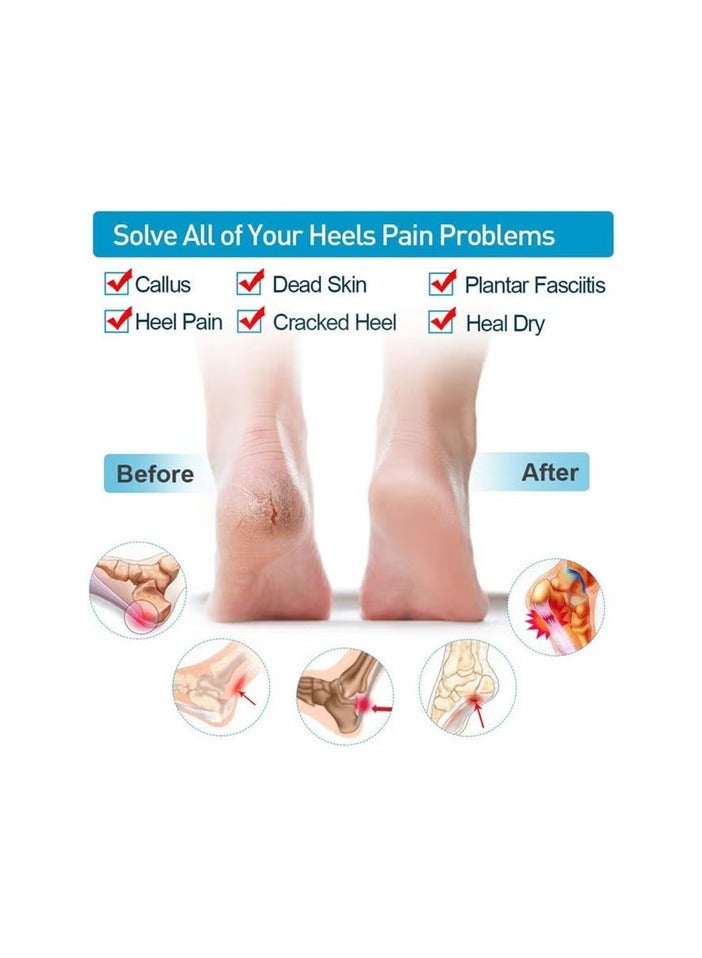 واقيات كعب من السيليكون الفاخر للأحذية، وأكواب كعب من الجل ونعل مبطن للنساء والرجال، وأكواب نعل مبطنة لعلاج التهاب اللفافة الأخمصية لتخفيف تشققات نعل القدم ومنع ظهور البثور - Image 2