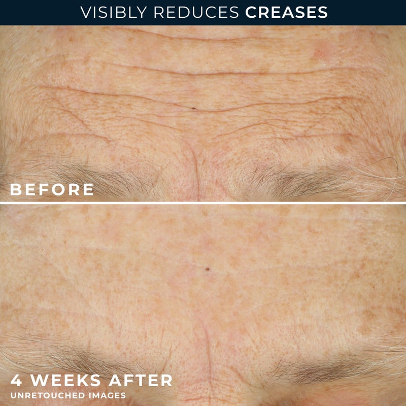 RoC كريم ترطيب الوجه اليومي المضاد للشيخوخة من روك كريب مع كريم شد الرقبة (1.7 أونصة) + كبسولات روك ريتينول لتنعيم التجاعيد (7 عدد) ، روتين العناية بالبشرة للنساء والرجال - Image 5