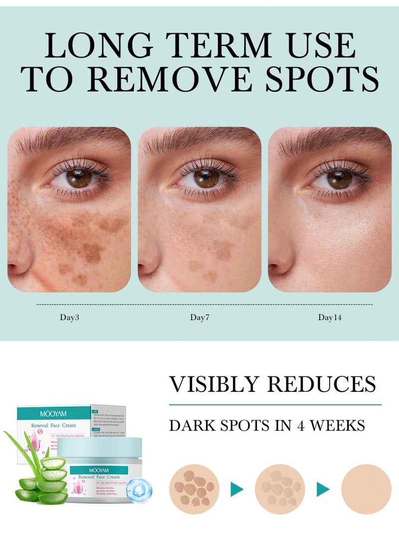 موويام كريم تجديد الوجه لعلاج الكلف والنمش لجميع أنواع البشرة، كريم تجديد الوجه المضاد للتجاعيد والمقشر والمبيض كريم تجديد الوجه - 50 جرام - Image 3
