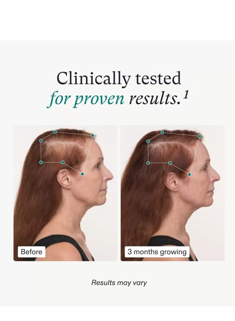 Wins Town Women's Balance Hair Growth Supplements, Ages 45 and Up, Clinically Proven for Visibly Thicker Hair and Scalp Coverage, Dermatologist Recommended - 1 Month Supply - Image 2
