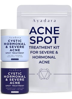 Day & Night Cystic Acne Spot Treatment Hormonal Acne Treatment For Daytime & Overnight Severe Acne Cystic Acne Treatment For Face Pimple Cream Tea Tree Bentonite Clay 90 Day Supply