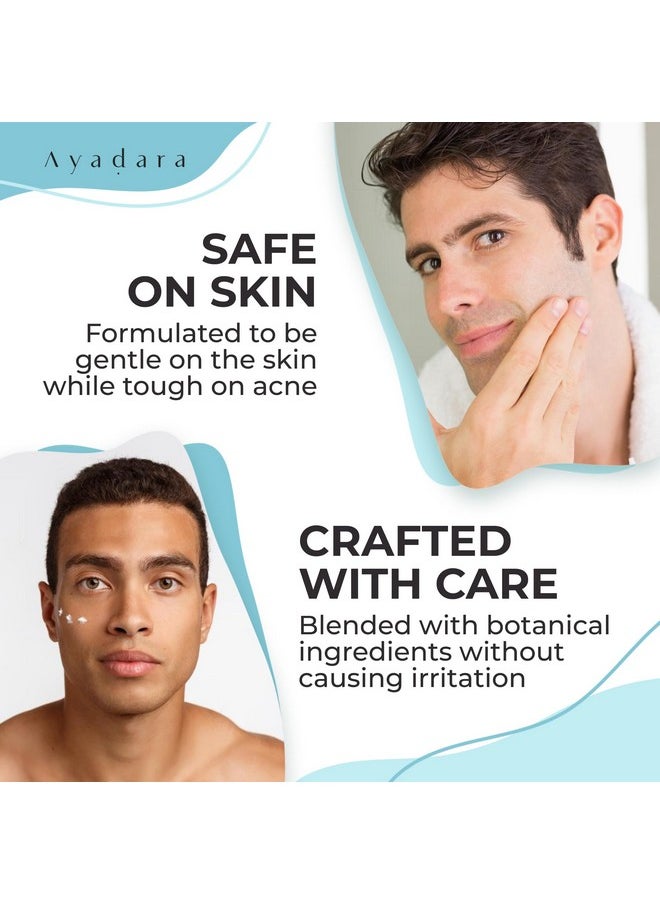 AYADARA - Day & Night Cystic Acne Spot Treatment Hormonal Acne Treatment For Daytime & Overnight Severe Acne Cystic Acne Treatment For Face Pimple Cream Tea Tree Bentonite Clay 90 Day Supply - Image 1
