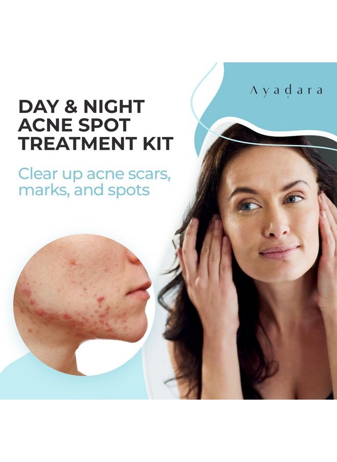 AYADARA - Day & Night Cystic Acne Spot Treatment Hormonal Acne Treatment For Daytime & Overnight Severe Acne Cystic Acne Treatment For Face Pimple Cream Tea Tree Bentonite Clay 90 Day Supply - Image 1
