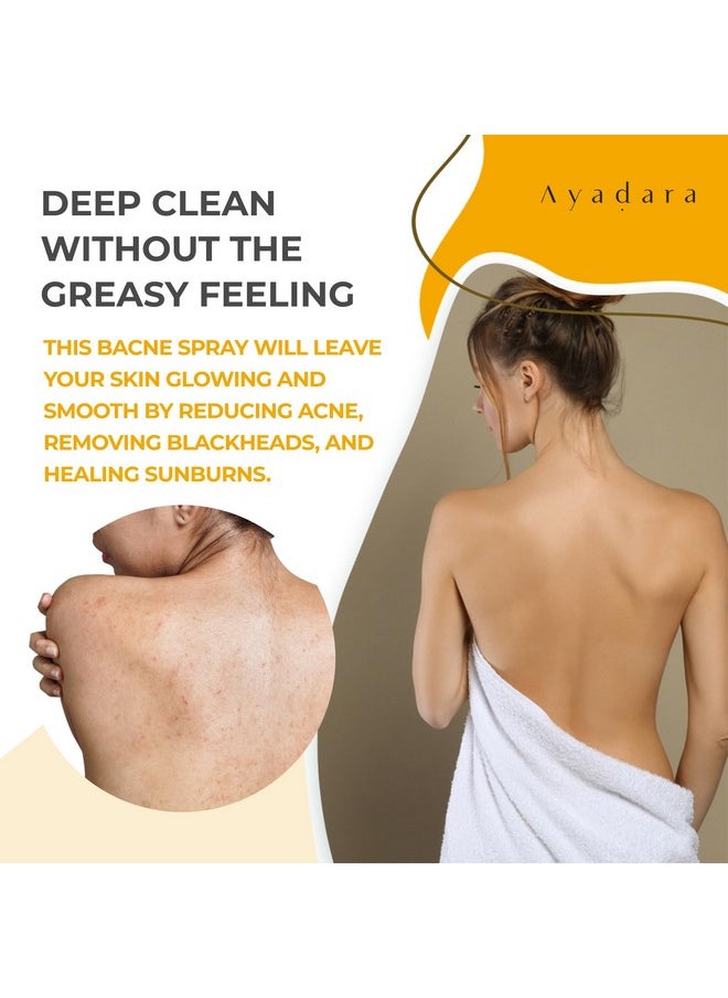 AYADARA - Acne Treatment Body Spray, 8 Fl Oz, Cystic Back Acne Treatment Spray With Salicylic Acid, Tea Tree Chest, Butt And Body Acne Spray For Hormonal Acne, Bacne Treatment For Teens Adults, 2000 Sprays - Image 1