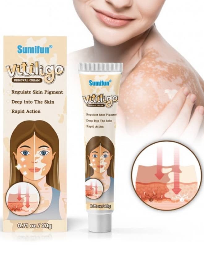 Sumifun كريم إزالة البهاق للوجه والجسم لتحسين لون البشرة وتقليل البقع البيضاء كريم علاج البهاق يقلل البقع البيضاء على البشرة يحسن لون البشرة كريم البهاق 20 جرام - Image 1