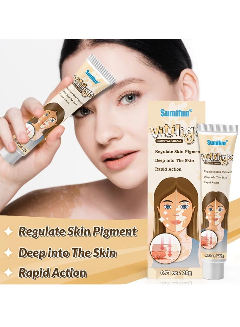 Sumifun كريم إزالة البهاق للوجه والجسم لتحسين لون البشرة وتقليل البقع البيضاء كريم علاج البهاق يقلل البقع البيضاء على البشرة يحسن لون البشرة كريم البهاق 20 جرام - Image 2