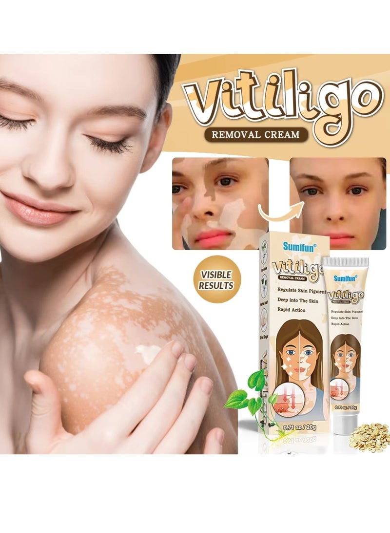 Sumifun كريم إزالة البهاق للوجه والجسم لتحسين لون البشرة وتقليل البقع البيضاء كريم علاج البهاق يقلل البقع البيضاء على البشرة يحسن لون البشرة كريم البهاق 20 جرام - Image 4