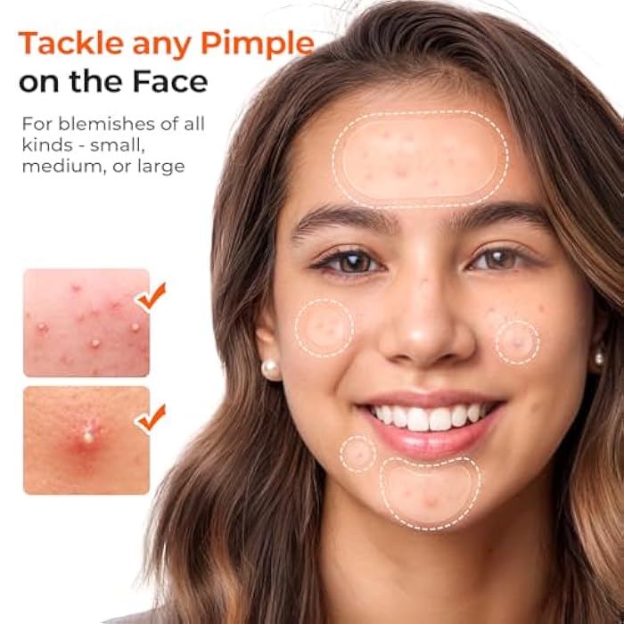 TKTK 443 Count Pimple Patches for Face, Hydrocolloid Acne Patch Bulk, Acne Stickers for Covering Cheeks, Forehead, Chin Blemishes Zit Breakouts for All Skin Types (Dots, Strip, Contoured 5 Sizes) - Image 3