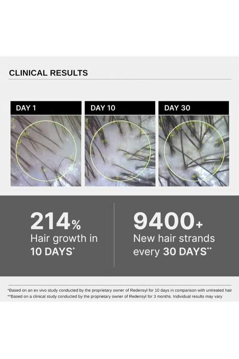 بار_اناتومي سيروم بير أناتومي المتطور لنمو الشعر | ٣٪ ريدينسيل - نتائج أفضل بمرتين من مينوكسيديل | + ٤٪ أناجين + ٣٪ بايكابيل | إكليل الجبل والبيوتين | سيروم لنمو الشعر ومنع تساقطه للنساء والرجال | ٣٠ مل - Image 5