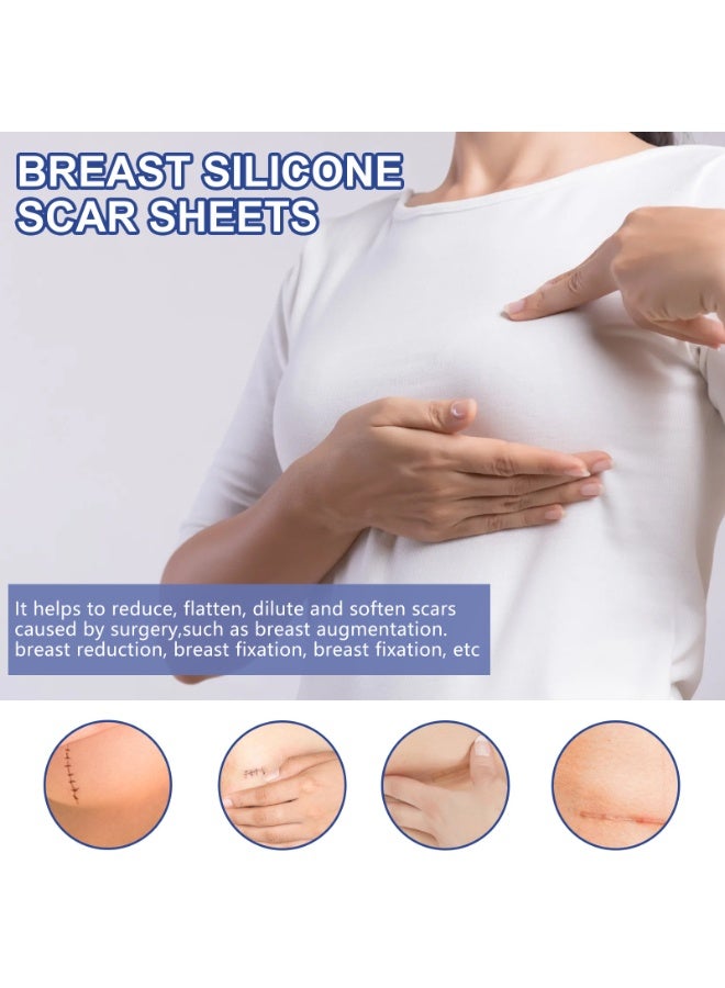إيلهو صفائح ندبات الثدي المصنوعة من السيليكون - غير مسببة للحساسية ومقاومة للماء وقابلة لإعادة الاستخدام - تقلل بشكل كبير من مظهر الندبات بعد الجراحة - Image 5
