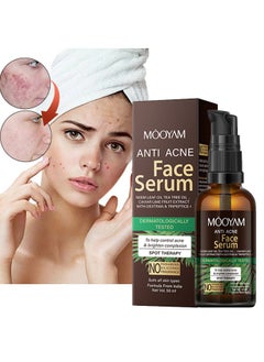 Anti Acne Face Serum, Neem Leaf Oil, Tea Tree Oil, Caviar Lime Fruit Extract with Dextran & Tripeptice-1 and Lemon Anti-Acne Face, Anti-wrinkle firming, Whitening Facial Repair Serum 50ml, for Acne Prone Skin Type