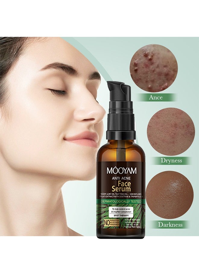 MOOYAM - Anti Acne Face Serum, Neem Leaf Oil, Tea Tree Oil, Caviar Lime Fruit Extract with Dextran & Tripeptice-1 and Lemon Anti-Acne Face, Anti-wrinkle firming, Whitening Facial Repair Serum 50ml, for Acne Prone Skin Type - Image 1