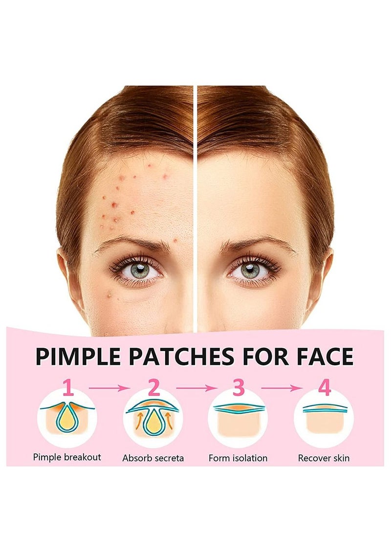 Generic - Star Pimple Patch (18 Counts) Face Acne Patches Star Hydrocolloid Acne Patches - Image 1