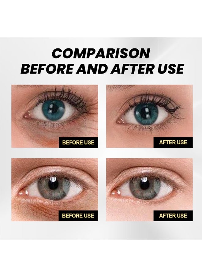 EELHOE Eye Cream Tightens The Skin Around The Eyes, Moisturizes And Lightens Wrinkles, Dark Circles And Bags Under The Eyes  - Image 4