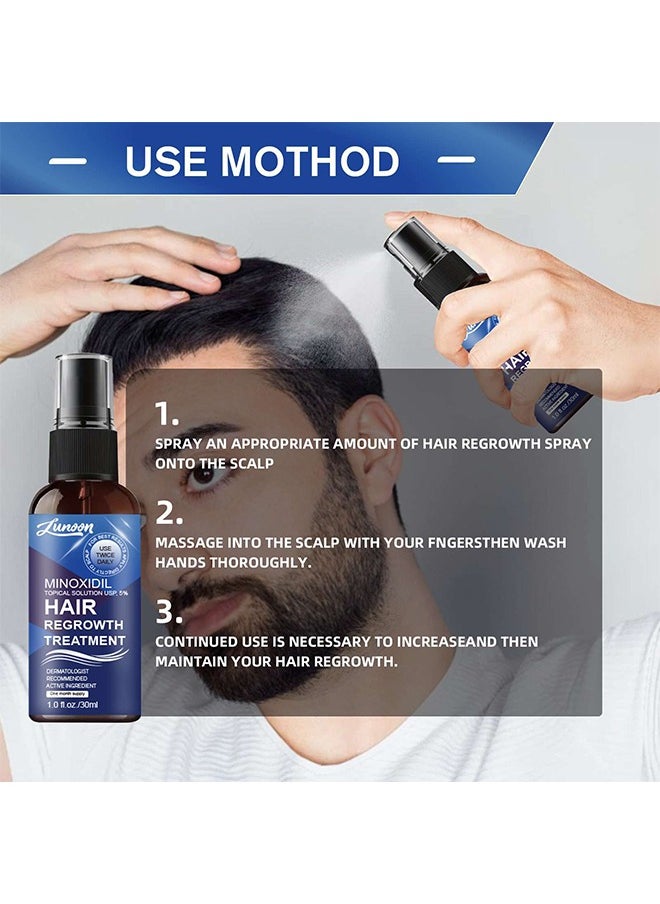 Minoxidil Hair Regrowth Treatment - Growth Spray For Men and Women , 5% Minoxidil Hair Serum For Stronger Thicker Longer Hair Help to Stop Thinning and Loss Hair 30ml - pzsku/Z88B192501E34F2C876DCZ/45/_/1732345659/76b4924a-0189-4d35-9405-fbf96e9ec276