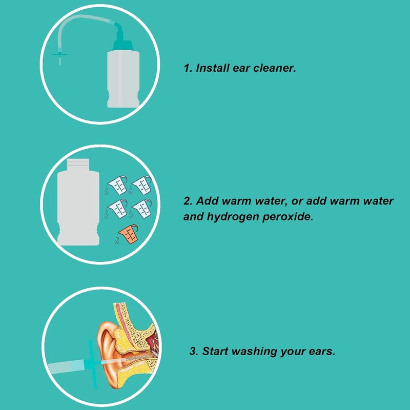 klarako Ear Wax Cleaner Kit, Ear Cleaner Cleaning Bottle Earwax Removal Kit Irrigation Set for Cleaning The Ears of Children and Adults - Image 2