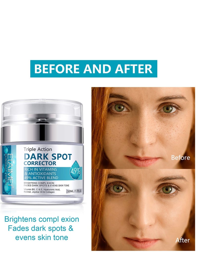 Elaimei Dark Spot Corrector For Face And Body, Dark Spot Corrector Cream, Melasma Treatment, Hyperpigmentation Treatment, Freckle Remover With Tranexamic Acid, Niacinamide, Squalane And Vitamin E Serum 50ml  - Image 2