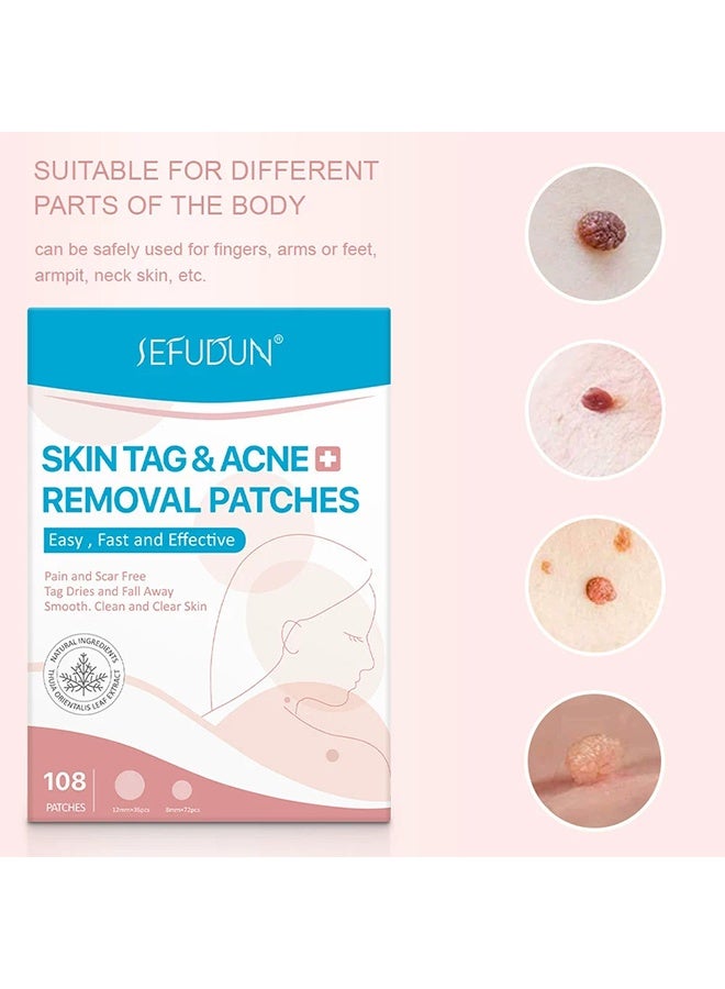 Sefudun Wart Removal Patches, Skin Care Removal Patches, High Strength, Quick and Easy Operation, Waterproof Invisible Stickers - 108 pieces	"Say goodbye to warts in a gentle way! Our botanical formula cares for your skin while working effectively. Let the patch do the work! Powerful ingredients penetrate deeply and break down warts easily. No stains, no stress! Each patch is individually wrapped for easy preservation. Be cautious and stay confident! Waterproof and invisible, works day and night. Take care of warts anytime, anywhere! Small and portable - perfect for home, work or travel." - Image 2