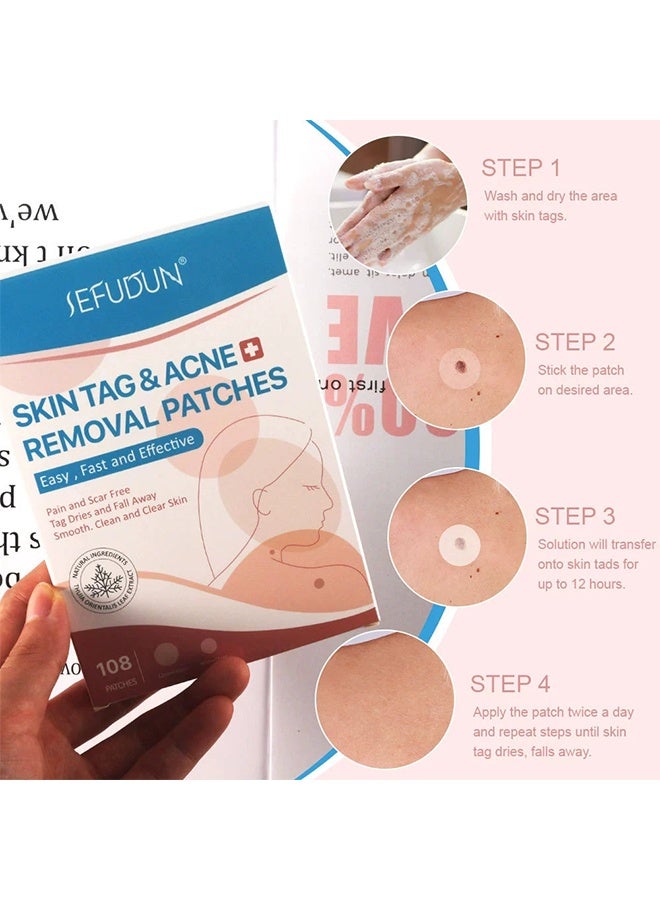 Sefudun Wart Removal Patches, Skin Care Removal Patches, High Strength, Quick and Easy Operation, Waterproof Invisible Stickers - 108 pieces	"Say goodbye to warts in a gentle way! Our botanical formula cares for your skin while working effectively. Let the patch do the work! Powerful ingredients penetrate deeply and break down warts easily. No stains, no stress! Each patch is individually wrapped for easy preservation. Be cautious and stay confident! Waterproof and invisible, works day and night. Take care of warts anytime, anywhere! Small and portable - perfect for home, work or travel." - Image 4