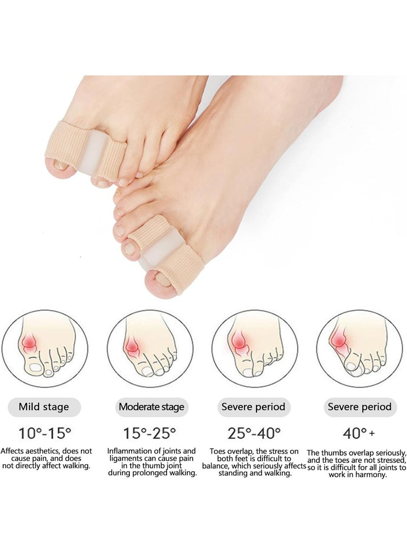 بتيمفم طقم تقويم العظام لتصحيح إبهام القدم وفاصل أصابع القدم لتخفيف إبهام القدم الأروح، جبيرة قابلة للتعديل وفواصل جل لأصابع القدم لمحاذاة أصابع القدم وتسكين الألم والحفاظ على صحة القدم على المدى الطويل للرجال والنساء. - Image 4