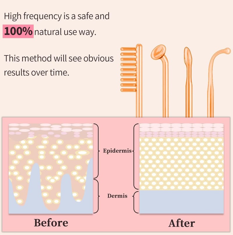High-Frequency Facial Machine | 4-in-1 Wand Portable Skin and Hair Beauty Device - Image 3