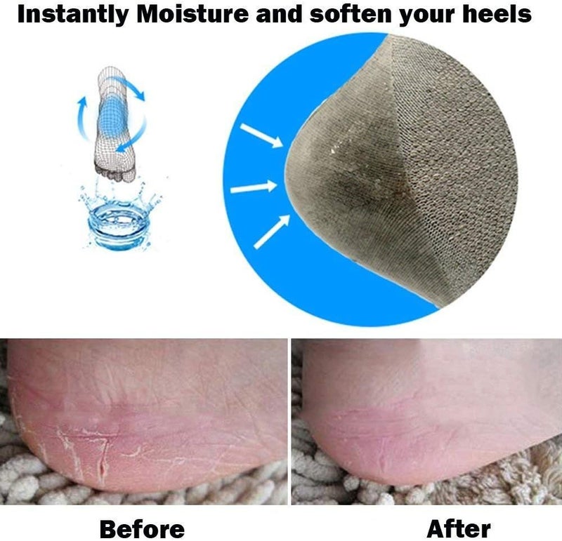 Codream Vented Moisturizing Socks Lotion Gel for Dry Cracked Heels Spa Gel Socks Humectant Moisturizer Heel Balm Foot Treatment Care Heel Softener Compression 2 Pairs - Image 5