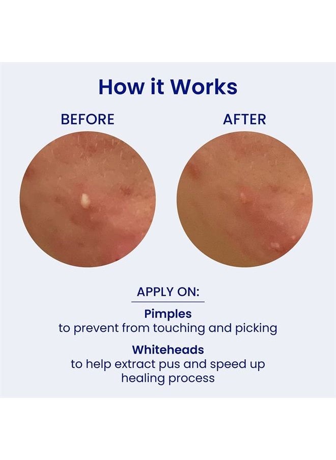 FACETORY - AM Spot Fighter Acne Blemish Patches for Pimples- Invisible Spot Treating Patch for Morning and Daytime, 72 Hydrocolloid Patches Infused with Tea Tree and Cica, 2 Sizes 10mm and 12mm - Image 1