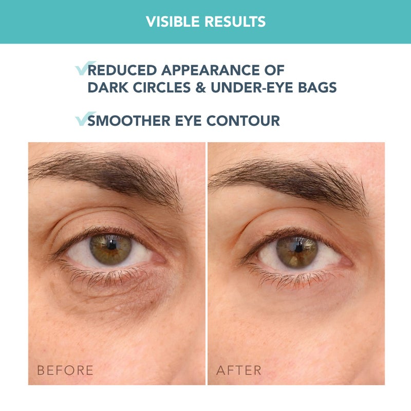 FOREO IRIS C-Concentrated Brightening Eye Cream for Dark Circles and Puffiness - Under Eye Brightener - Hyaluronic Acid - Antioxidant - Vegan - Travel Size - All Skin Types - 0.5 oz - Image 5