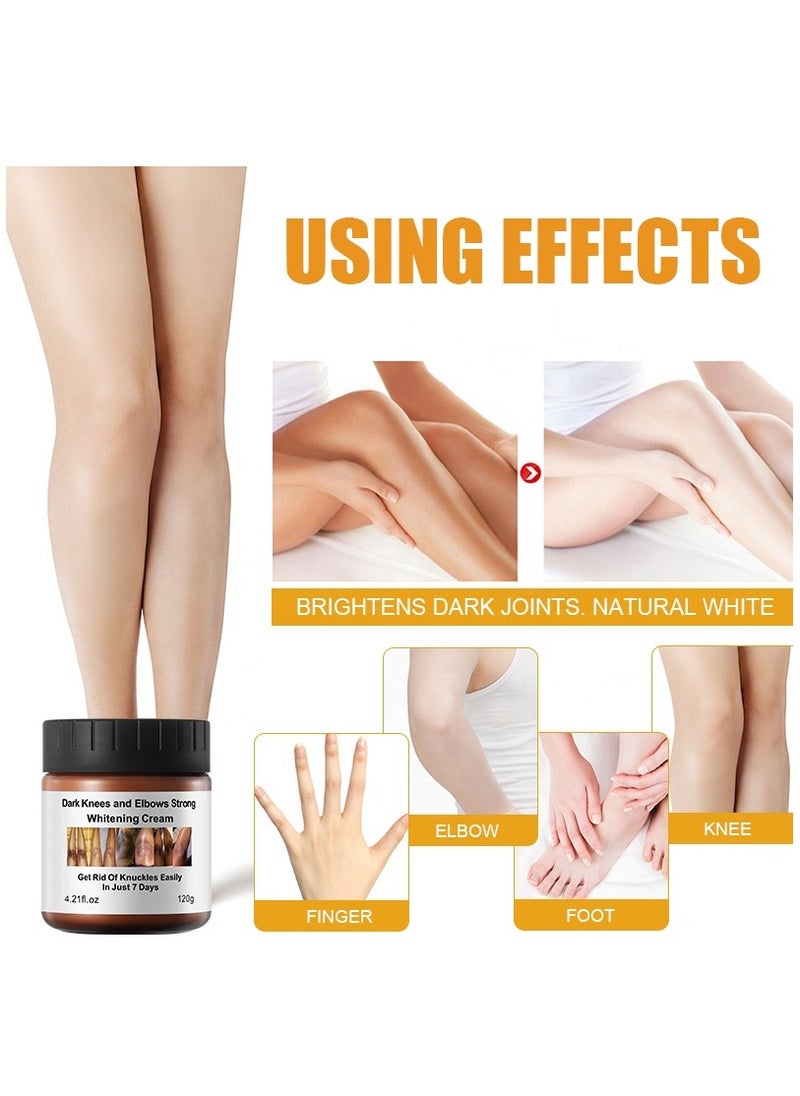 MOOYAM - Dark Knees and Elbows Strong Whitening Cream 120g Get Rid of Knuckles Easily in Just 7 Days Skin Whitening Improve Skin Tone Nourishing and Moisturizing Cream - Image 1
